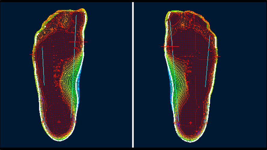 3D Plantar Scanner