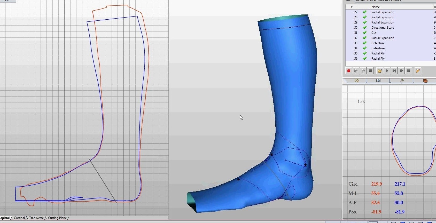 Shriners Hospital Training