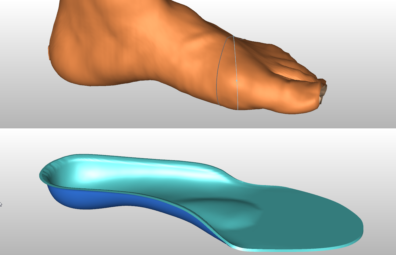 Canfit 205: Foot Orthosis Design