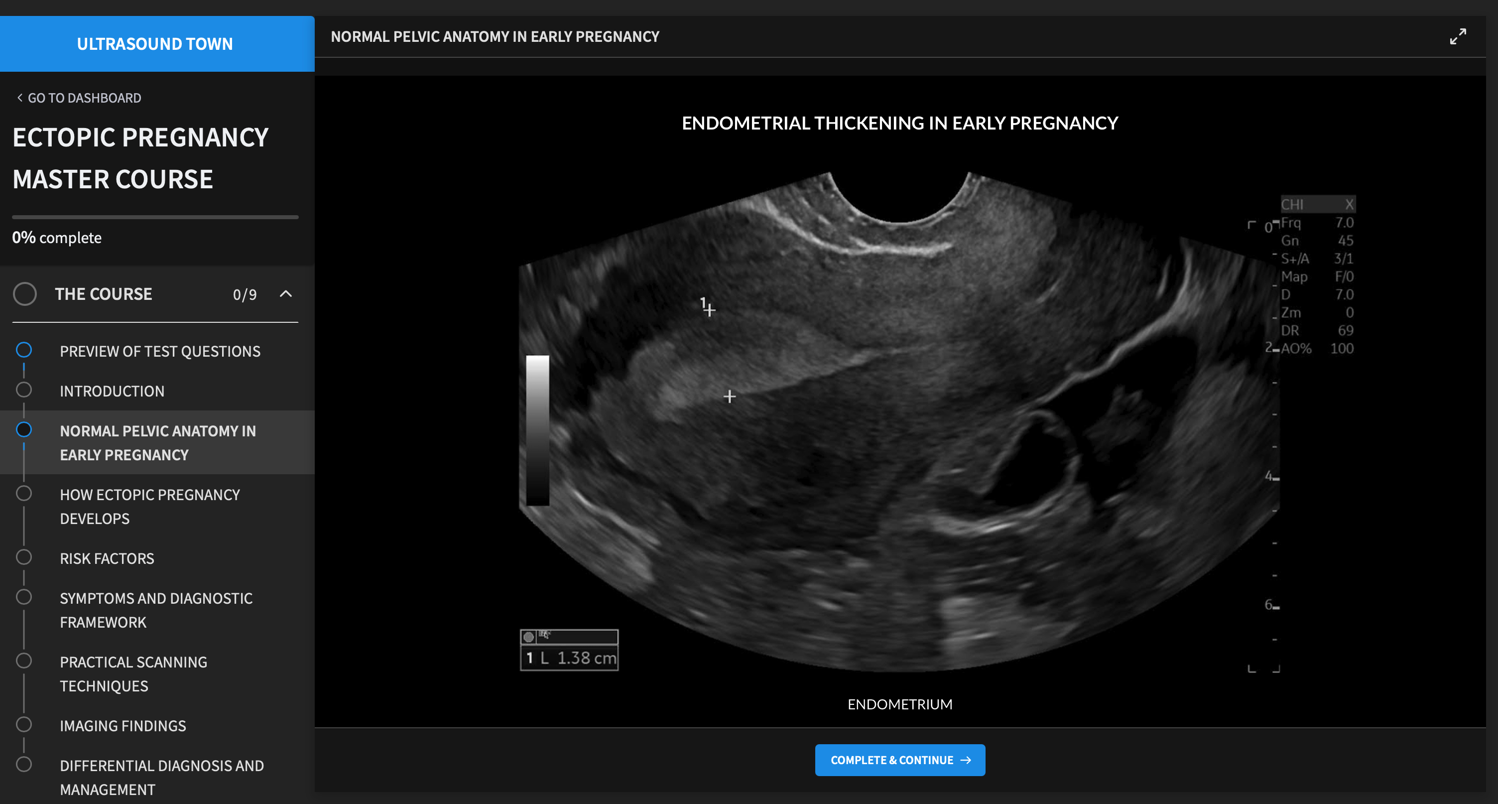 Ultrasound Town course player