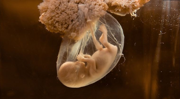 Fetus in the amnion with the umbilical cord and the placenta  (https://americanpregnancy.org/wp-content/uploads/2012/04/fetal_life_support.jpg)