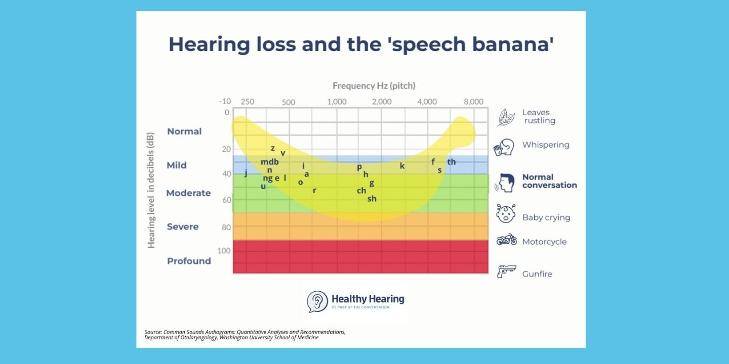 Audiogram showing normal hearing curve with the "speech banana" highlighted, peaking around 2000 Hz.