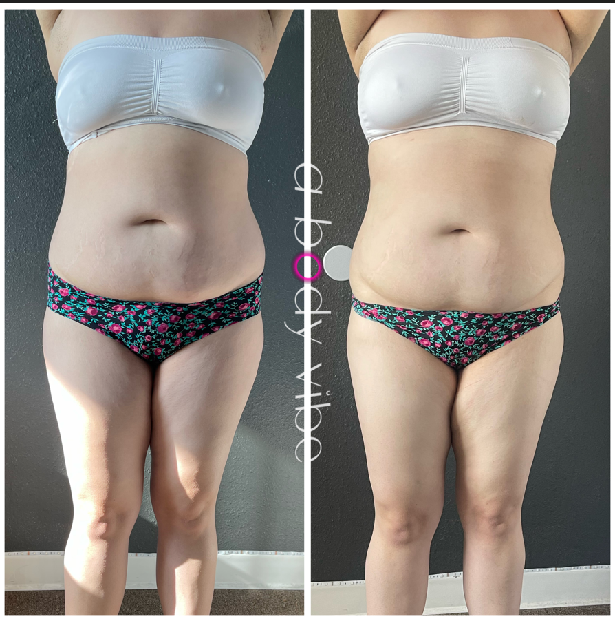 before and after results from one body wrap and infrared sauna session