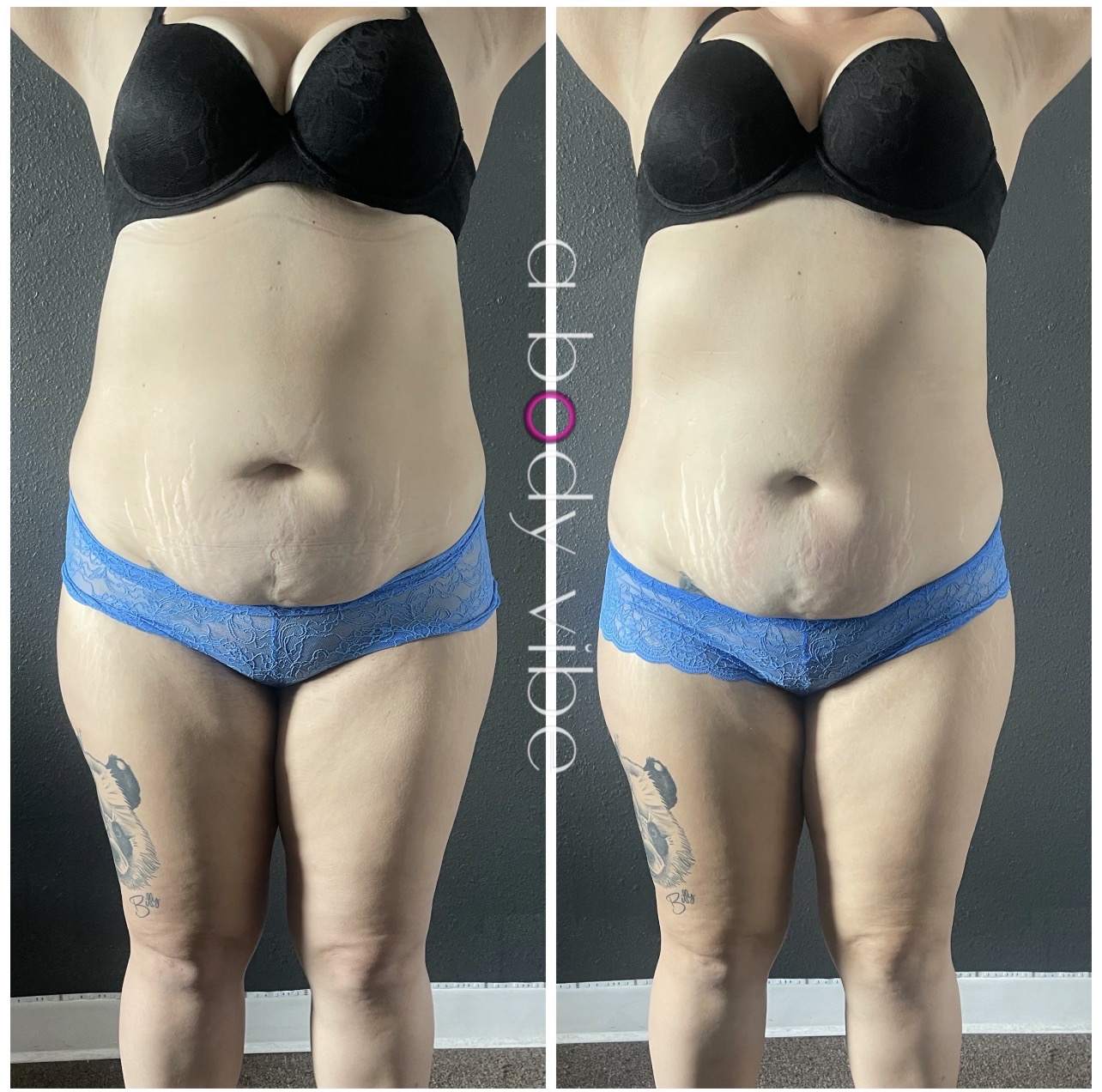 before and after results from one infrared sauna and body wraps session