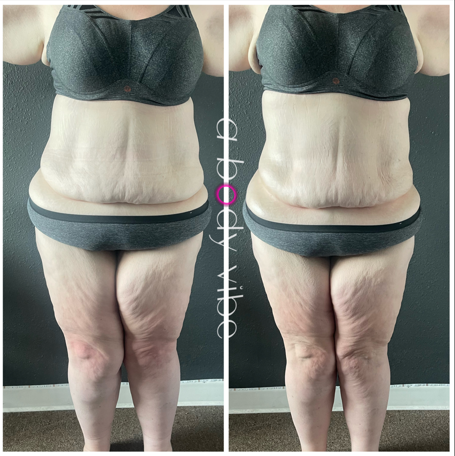 before and after results from one infrared sauna and body wrap session