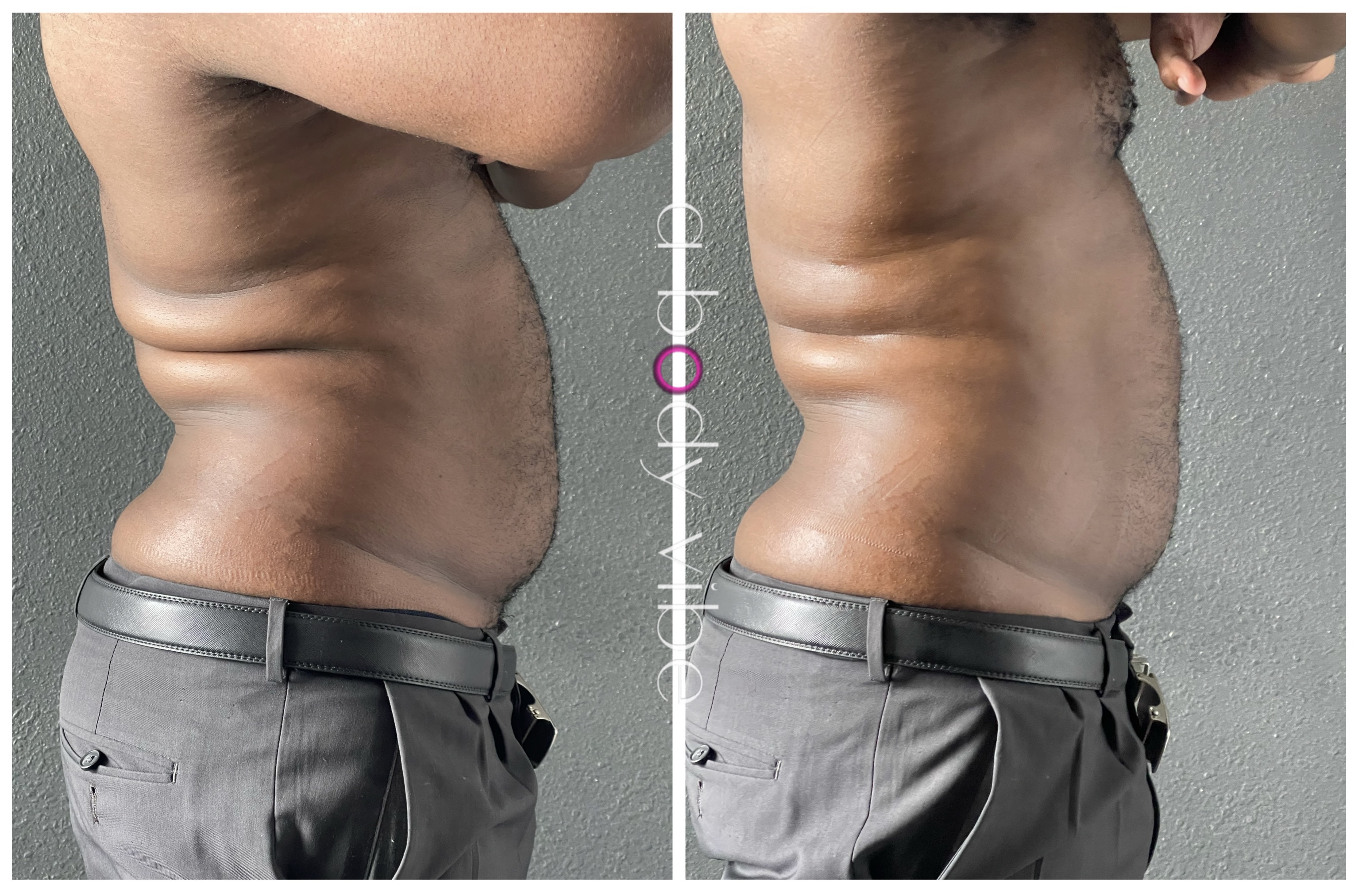 Before and after 1 wood therapy treatment 