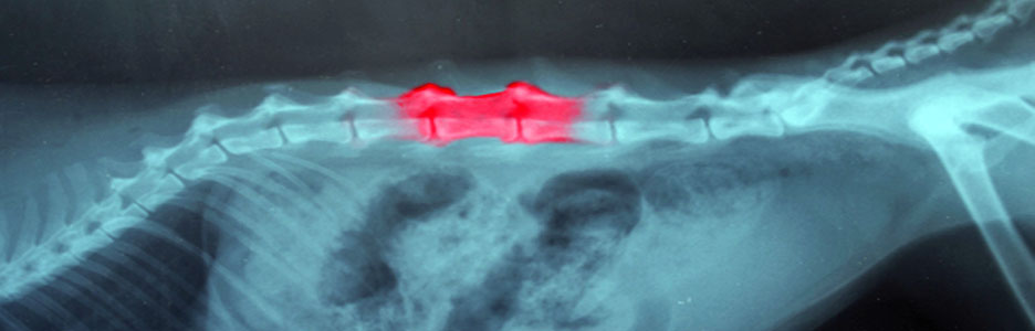 sp-spondylosis_BANNER