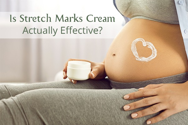 Is Stretch Marks Cream Actually Effective?