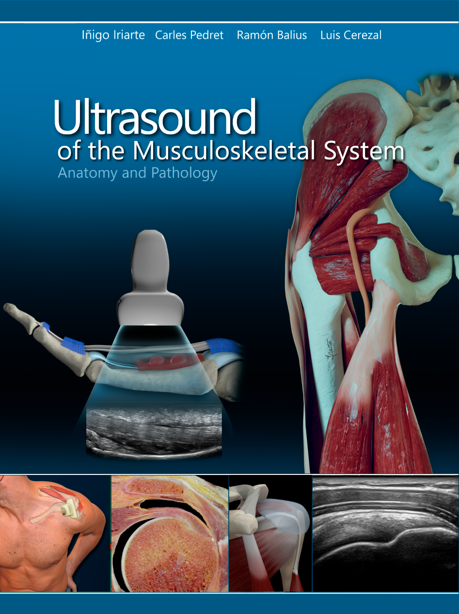Cover of Ultrasound of the Musculoskeletal System