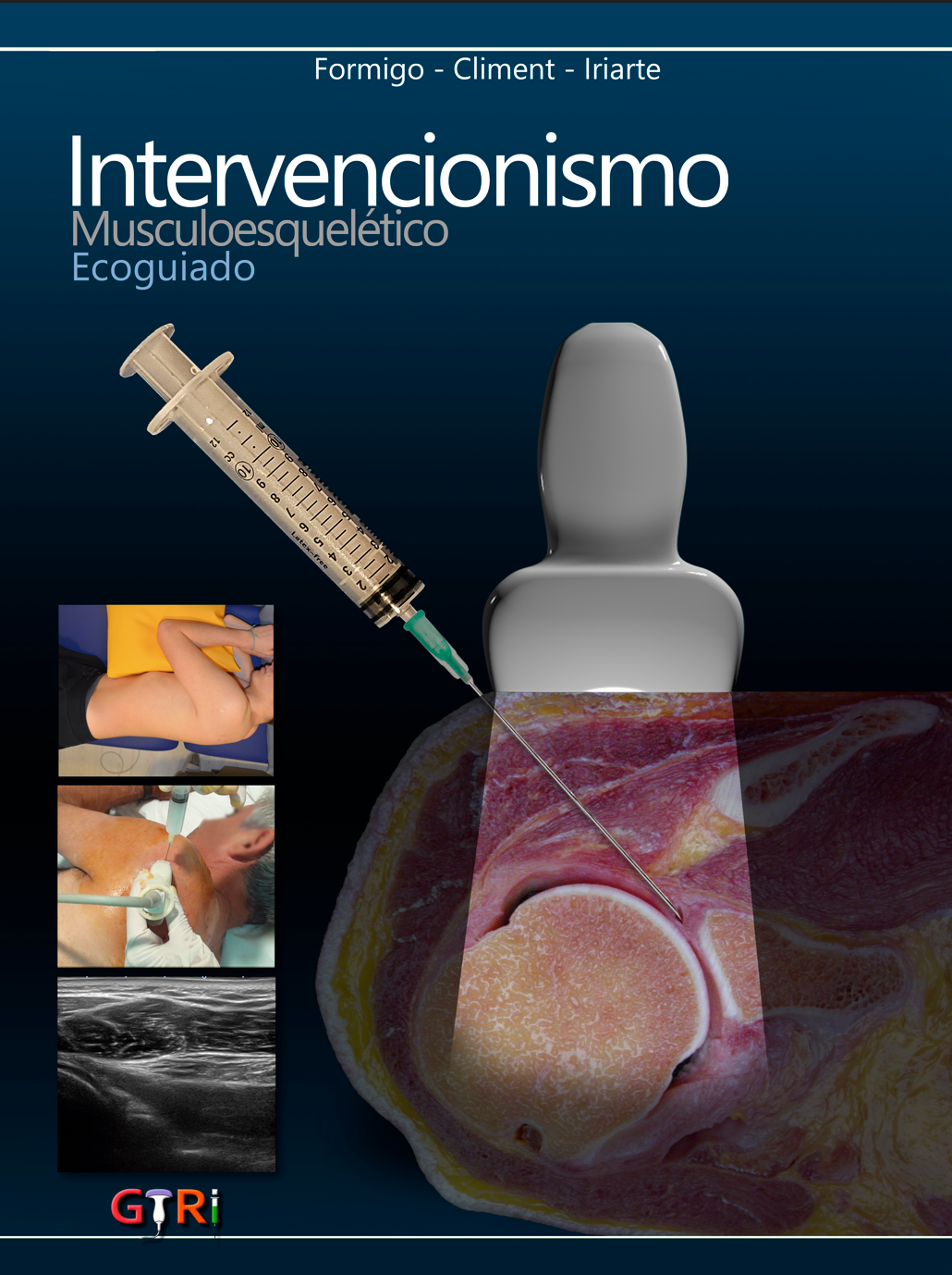 Cover of Intervencionismo Ecoguiado: Guía Práctica
